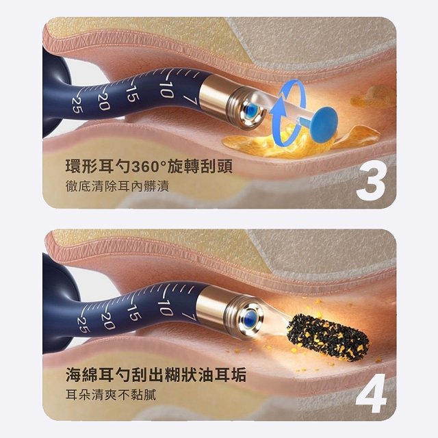 【Bebird 蜂鳥】ADAM 3 Ultra 多功能彎曲定型掏耳棒
