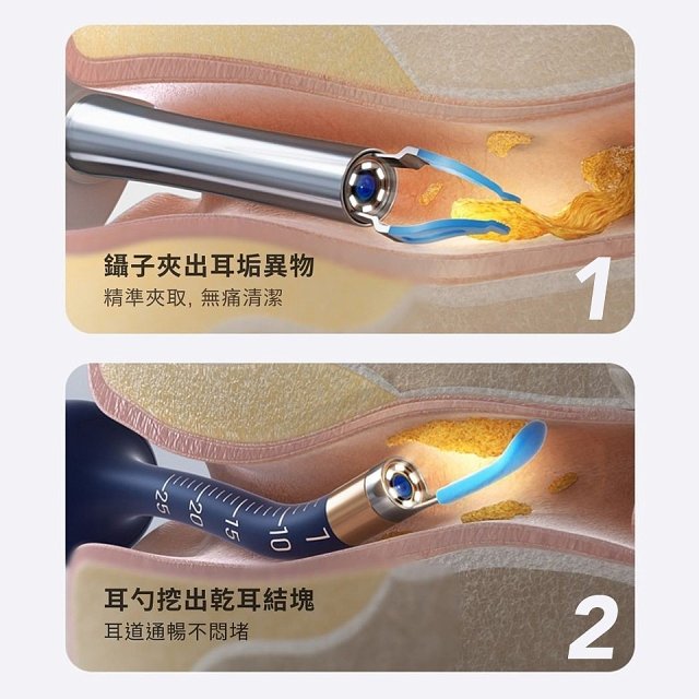 【Bebird 蜂鳥】ADAM 3 Ultra 多功能彎曲定型掏耳棒